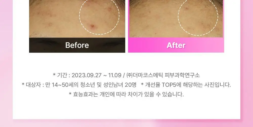 [속보습]코스알엑스 더 6 펩타이드 스킨 부스터 세럼 더블기획 상세페이지 25